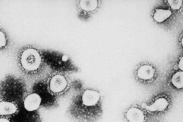 A magnified picture of coronavirus. Picture by Getty Images