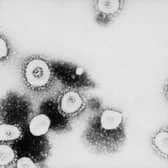 Coronavirus which has killed over 100,000 people across the country. A Banbury man is calling for the official list of symptoms to be updated on the Gov.uk website. Picture by Getty