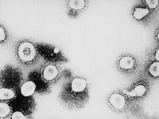 Coronavirus which has killed over 100,000 people across the country. A Banbury man is calling for the official list of symptoms to be updated on the Gov.uk website. Picture by Getty
