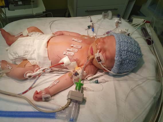 Baby Lucca Beadle who was found to have a congenital heart defect by Horton medics
