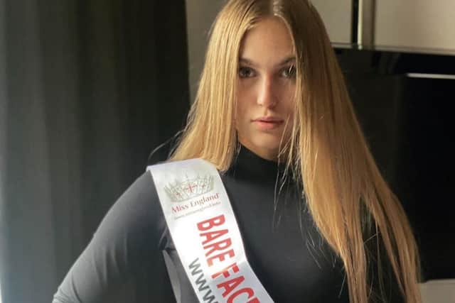 Rheanna previously won Miss England's bare face top model in 2021.