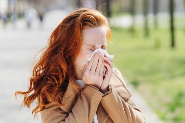 Photo of woman with hayfever symptoms sneezing