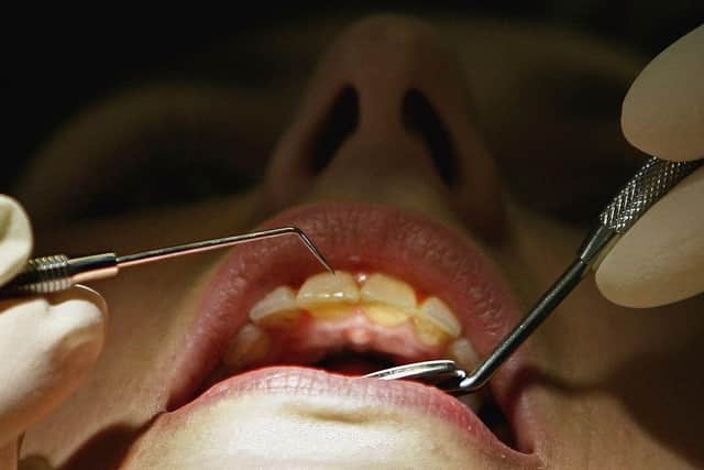 The British Dental Association says dentists are walking away from a 'broken system' of NHS care. Picture by Getty