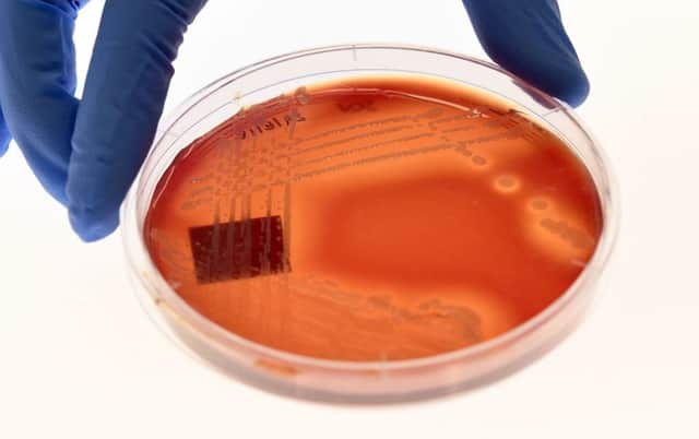 The bugs include strains of bacteria that can trigger life-threatening illnesses (Photo: Getty Images)