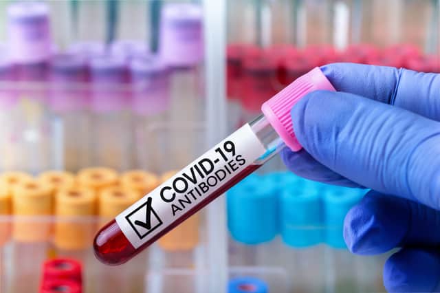 Covid-19 antibodies last for at least six months after infection for the majority of people (Photo: Shutterstock)