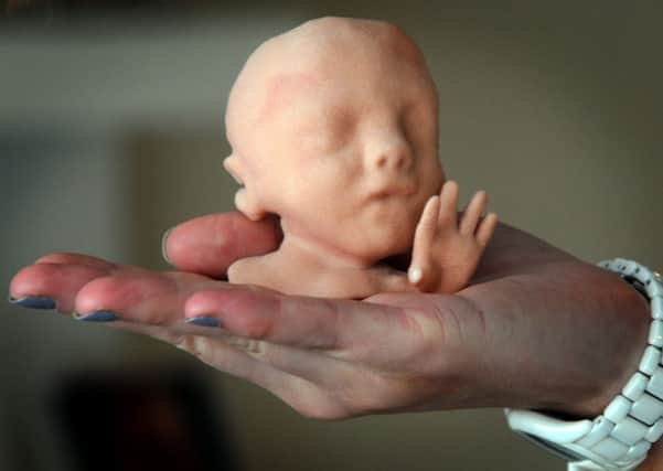 Expectant mums and dads can now hold their babies BEFORE they are born - with the introduction of 3D printed baby models. Photo: SWNS