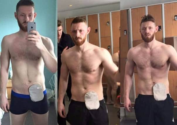 Karl Tucker, 25, of Banbury, who has Crohn's disease, has posted a series of selfies on Facebook to chart his progress back to fitness. NNL-161003-130513001